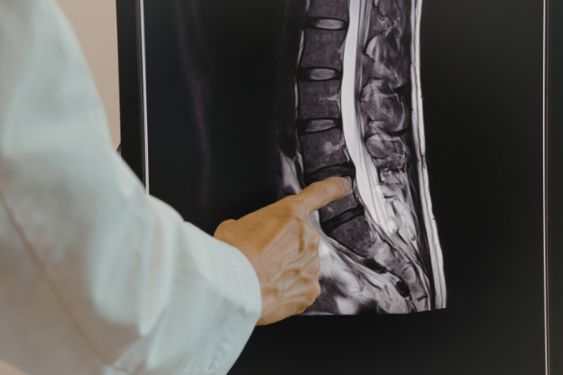 Spinal Decompression